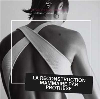 Photo chirurgien esthétique n°500 zone Bouches-du-Rhône par Chirurgie et médecine esthétique 